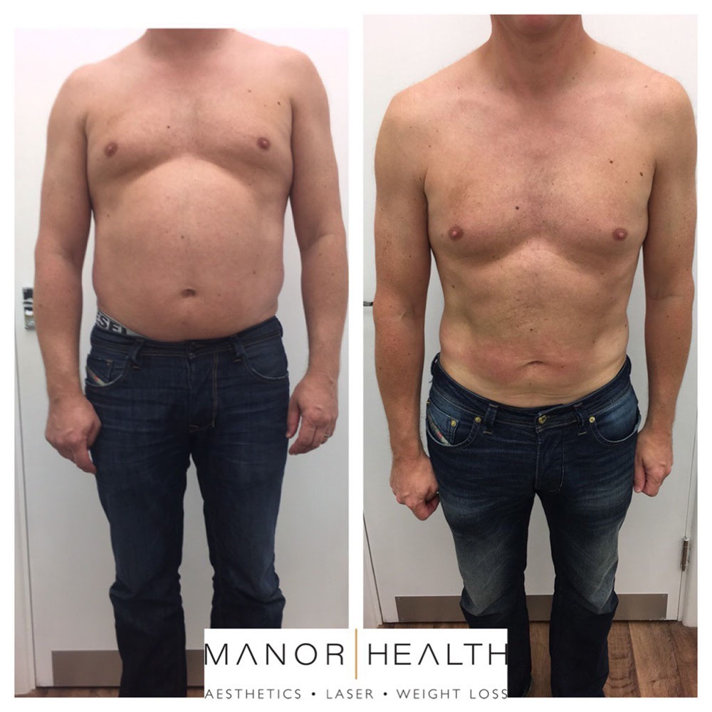 Weight Loss Transformation