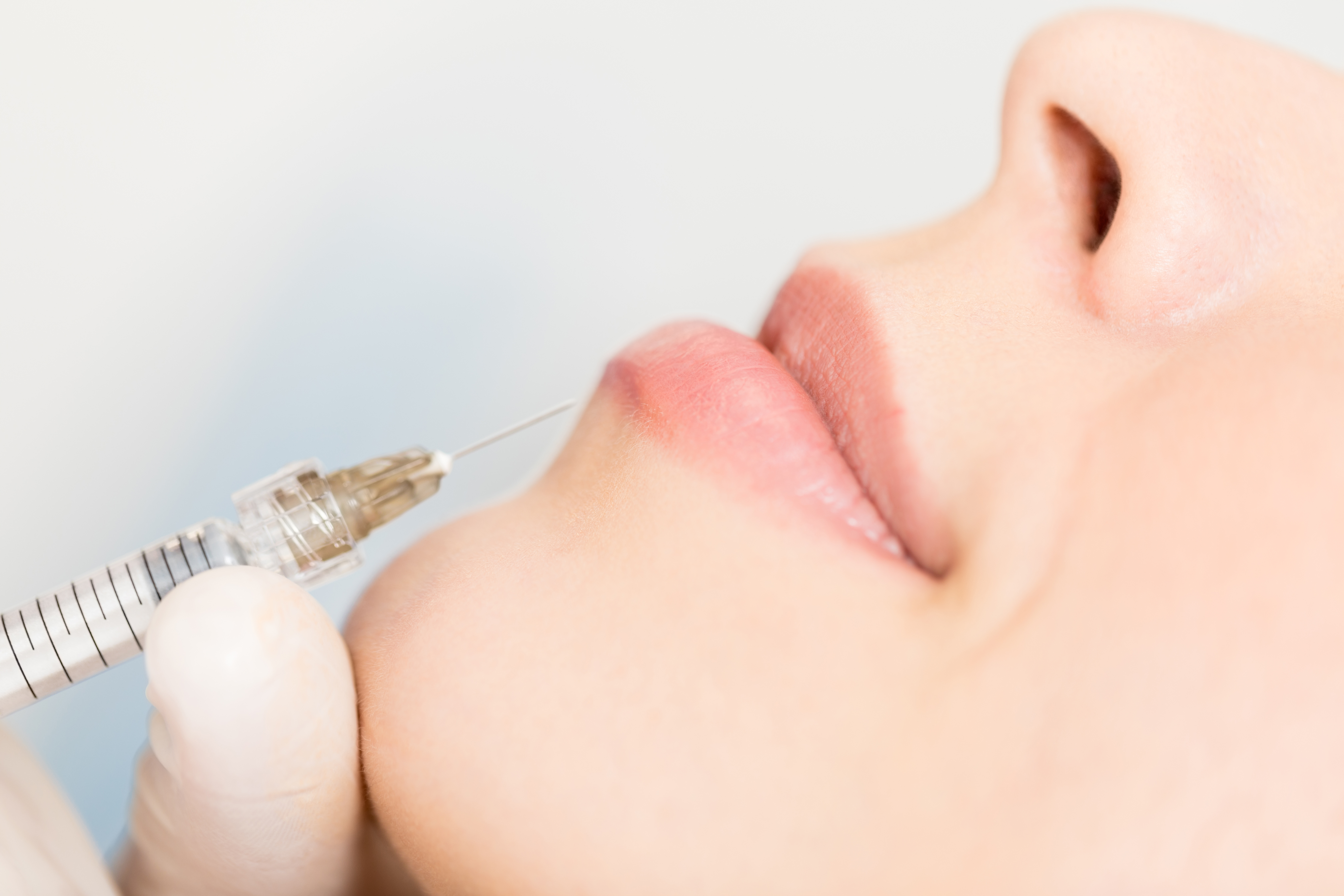 lip filler