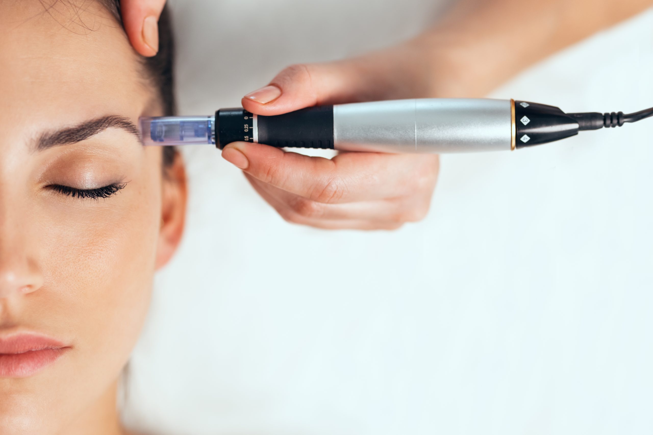 lady getting exosomes facial treatment