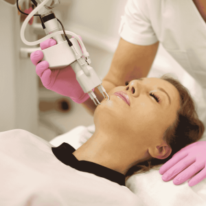 co2 laser resurfacing