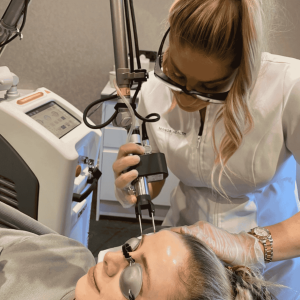 co2 laser skin treatment