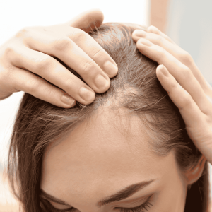 hair loss treatment