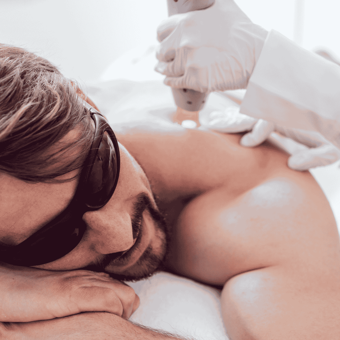 laser hair removal