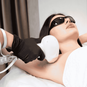 laser hair removal