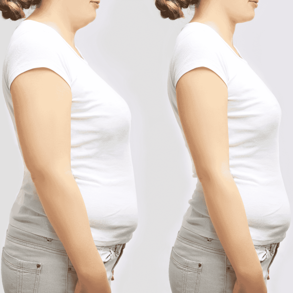 lymphatic drainage massage