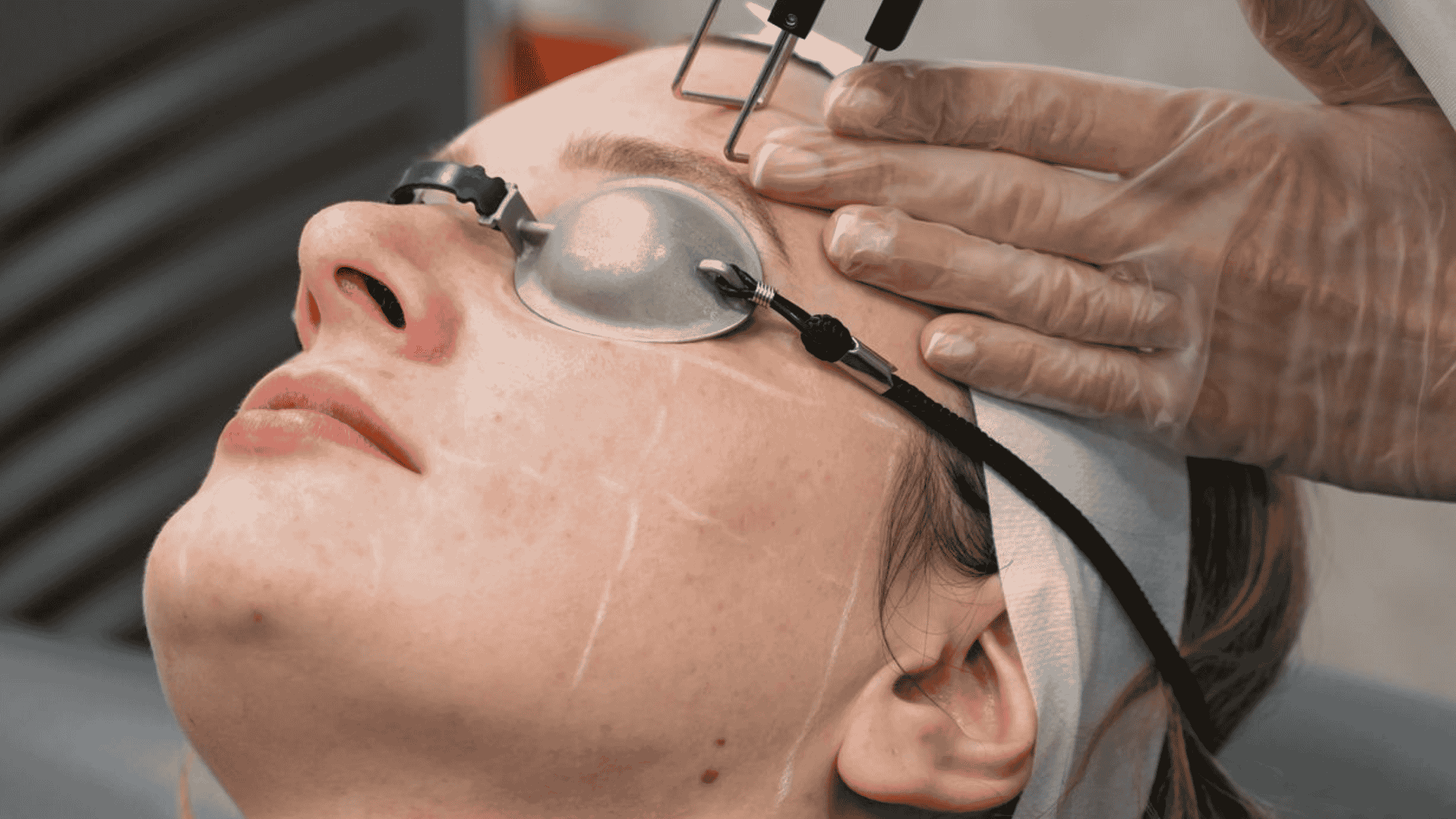 person getting co2 laser resurfacing