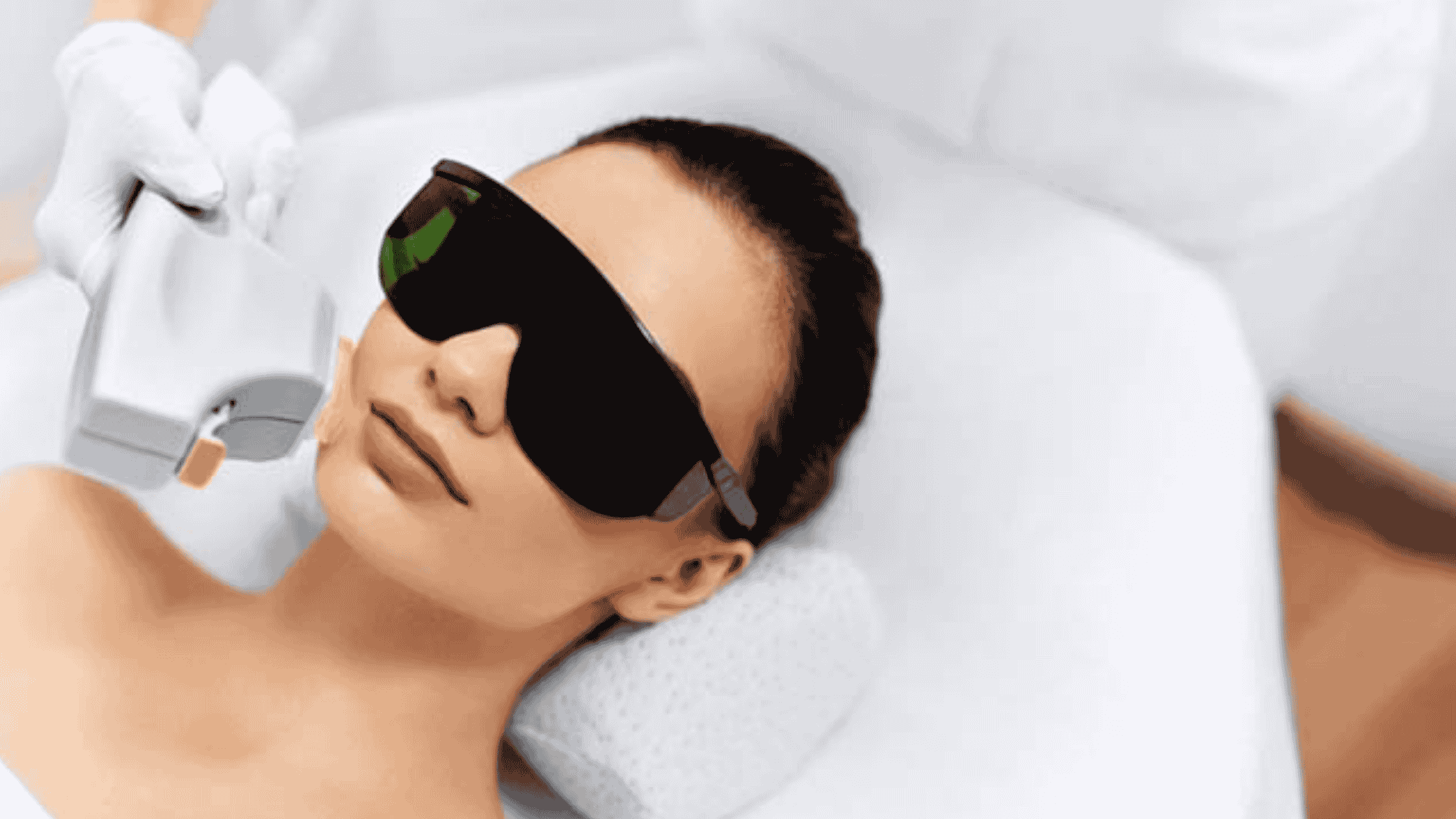 ipl laser facial